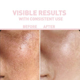 NIACINAMIDE 10% + ACIDE HYALURONIQUE 2% Advanced anti-blemish and pore-tightening formulation