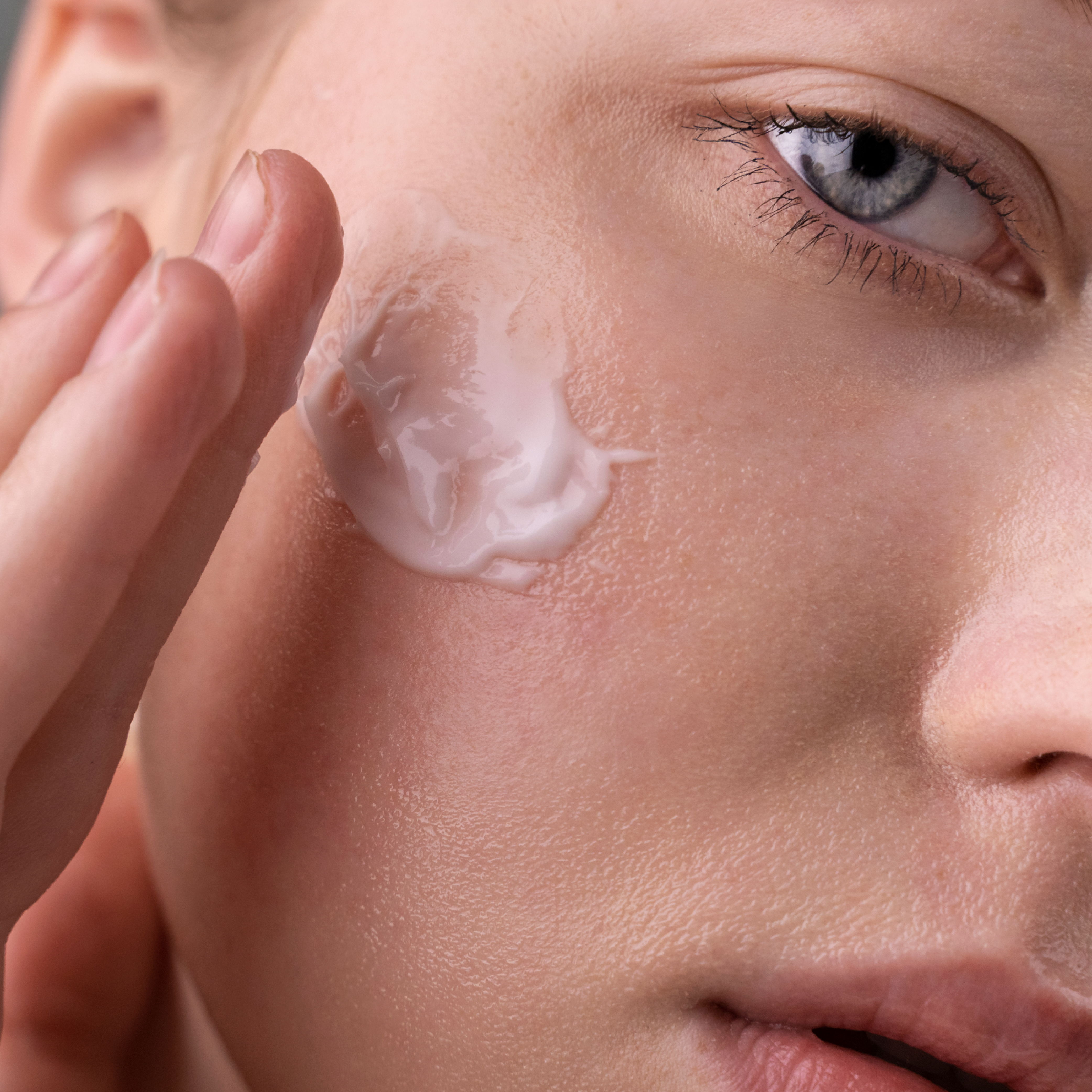 Acne-prone skin care