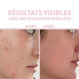 SALICYLIC ACID 2% + ICELAND MOSS CLEANSER