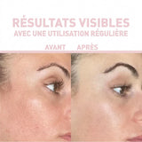 AHA 10% + BHA 2% + CRANBERRY EXFOLIATOR