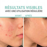 CRÈME RÉPARATRICE SÉBO-RÉGULATRICE POUR PEAUX GRASSES ET À TENDANCE ACNÉIQUE