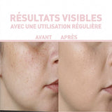 VITAMIN C 15% + FÉRULIC ACID 0.5% + BURDOCK SERUM