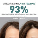 ANTI-HAIR LOSS SHAMPOO FOR NORMAL HAIR